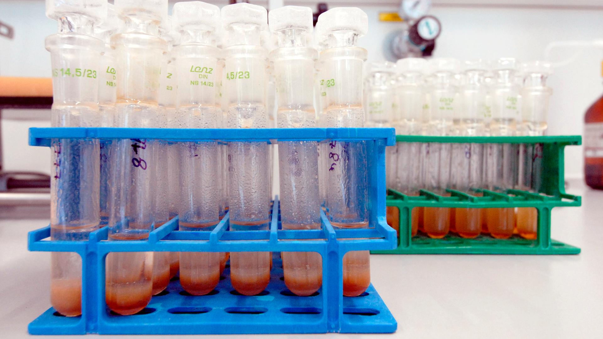 versiegelte analysierte ddr urinproben