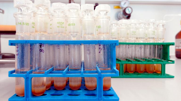 versiegelte analysierte ddr urinproben