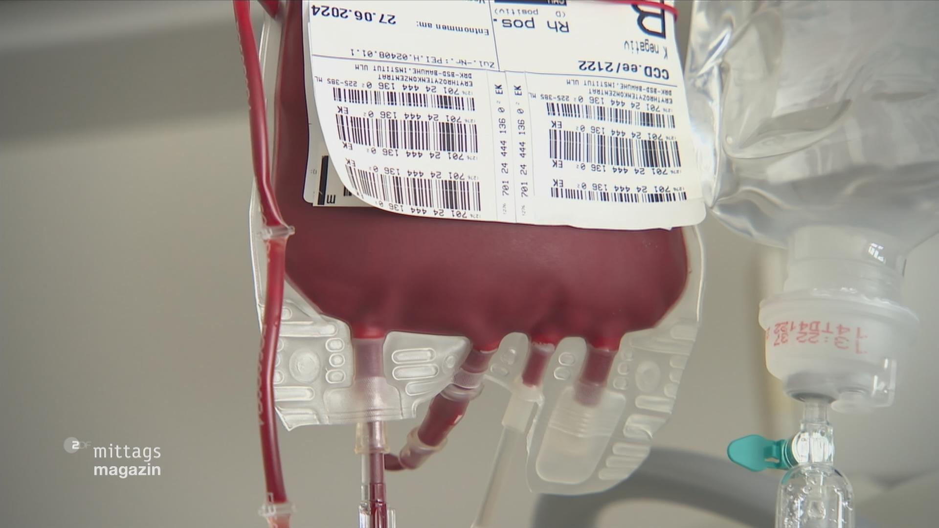 Symbolbild: Blutspende-Beutel gefüllt mit Blut