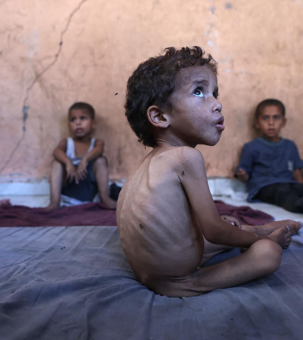 Yazan, ein unterernährter 2-jähriger palästinensischer Junge, sitzt mit seinen Brüdern in dem beschädigten Haus seiner Familie im Flüchtlingslager Al-Shati westlich von Gaza-Stadt, am 23. Juli 2025.