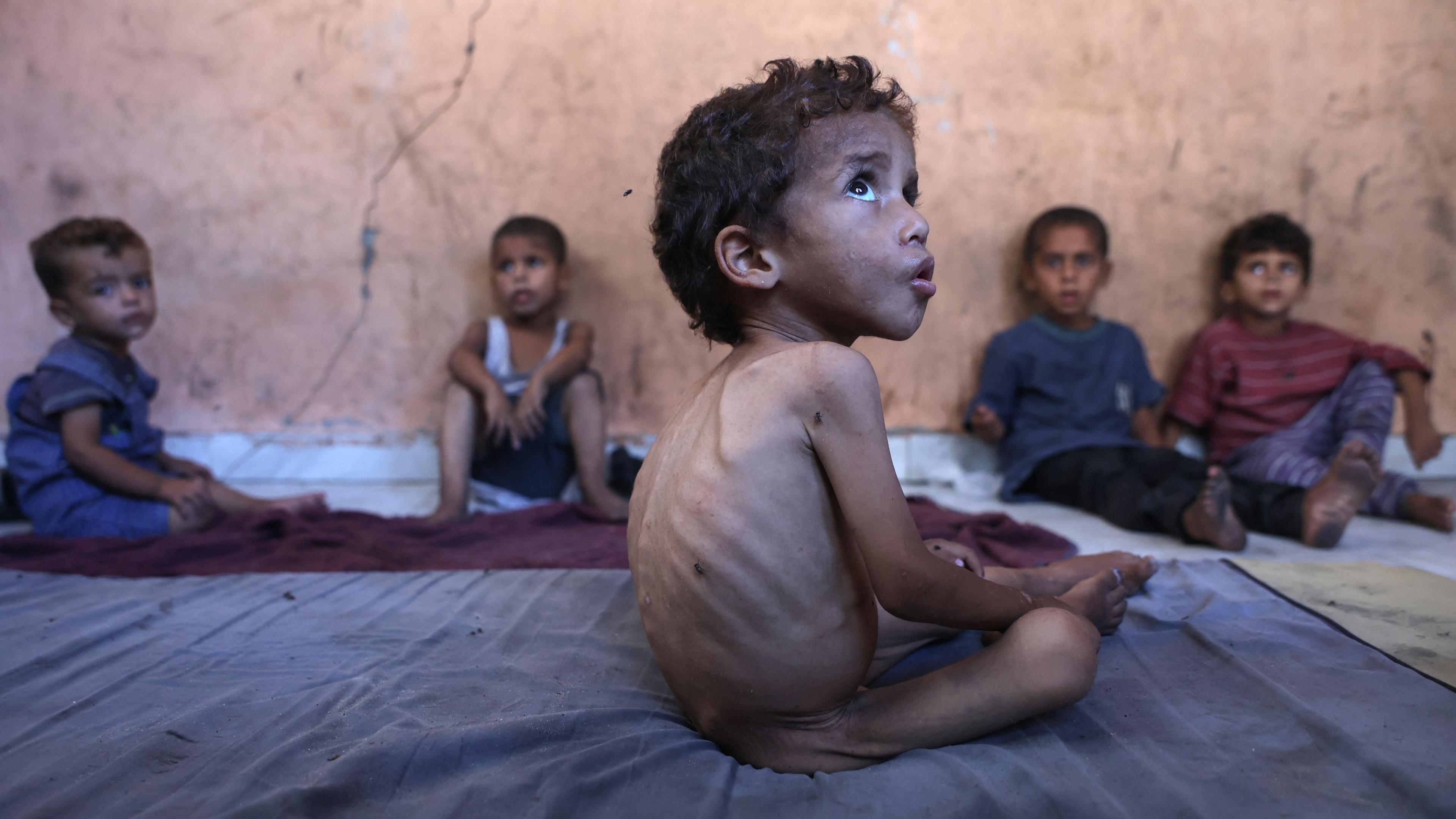 Yazan, ein unterernährter 2-jähriger palästinensischer Junge, sitzt mit seinen Brüdern in dem beschädigten Haus seiner Familie im Flüchtlingslager Al-Shati westlich von Gaza-Stadt, am 23. Juli 2025.