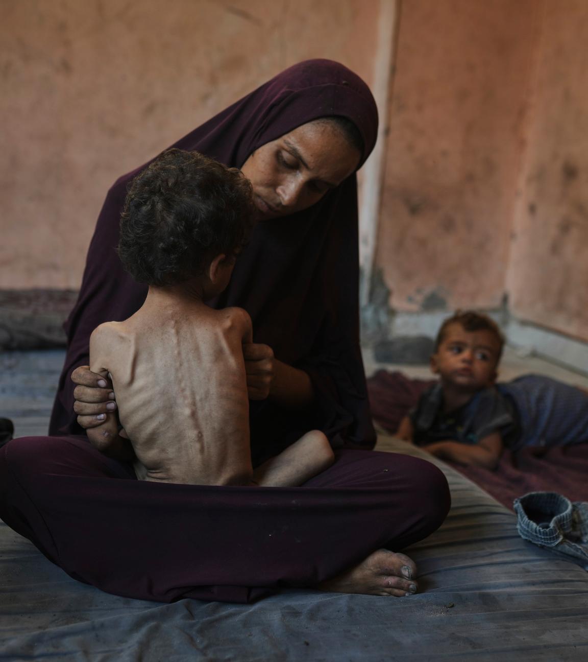 Naima Abu Ful posiert für ein Foto mit ihrem 2-jährigen unterernährten Kind Yazan in ihrem Haus im Flüchtlingslager Shati in Gaza-Stadt, Mittwoch, 23. Juli 2025