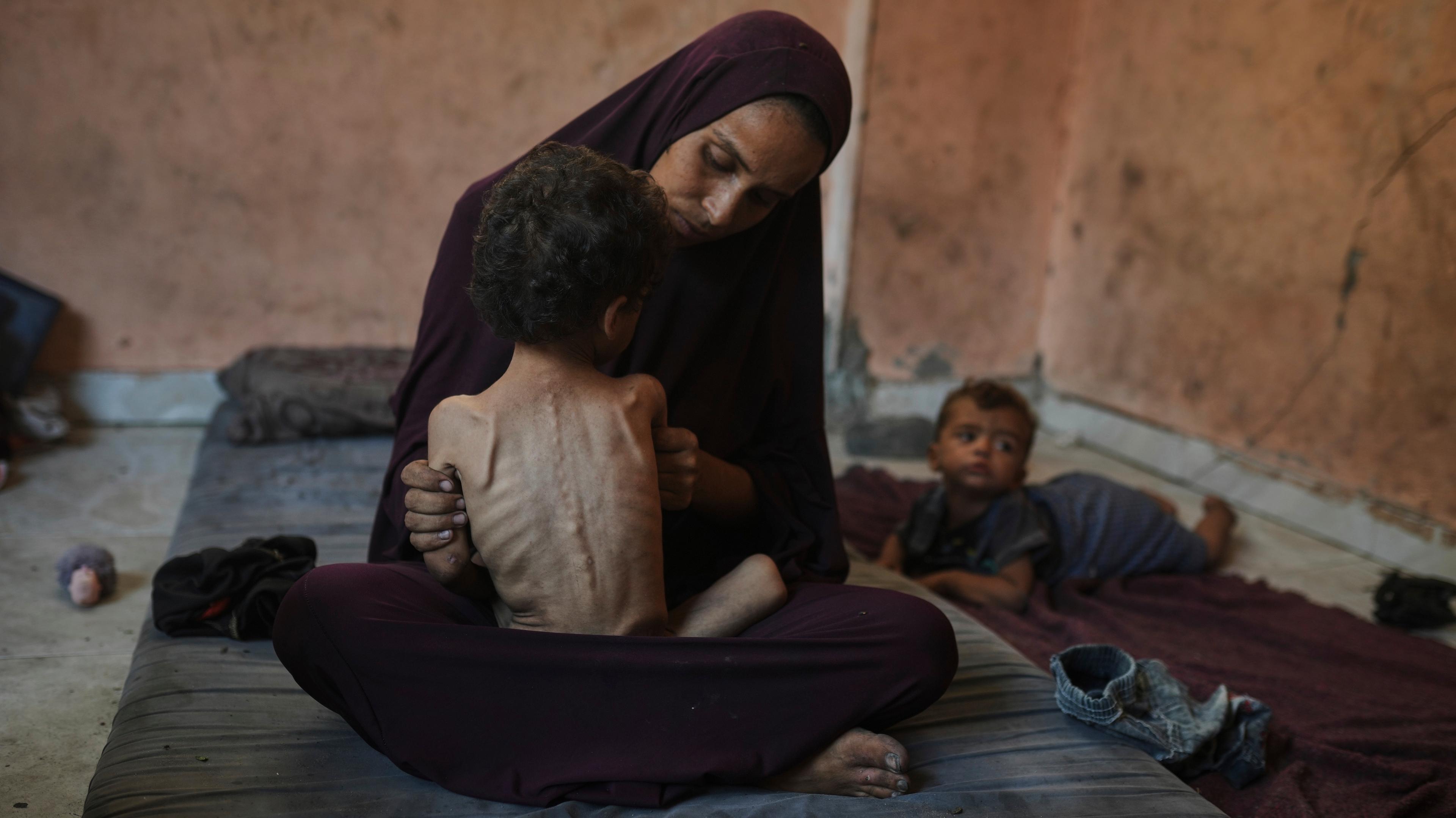 Naima Abu Ful posiert für ein Foto mit ihrem 2-jährigen unterernährten Kind Yazan in ihrem Haus im Flüchtlingslager Shati in Gaza-Stadt, Mittwoch, 23. Juli 2025