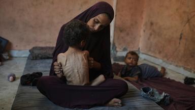 Naima Abu Ful posiert für ein Foto mit ihrem 2-jährigen unterernährten Kind Yazan in ihrem Haus im Flüchtlingslager Shati in Gaza-Stadt, Mittwoch, 23. Juli 2025