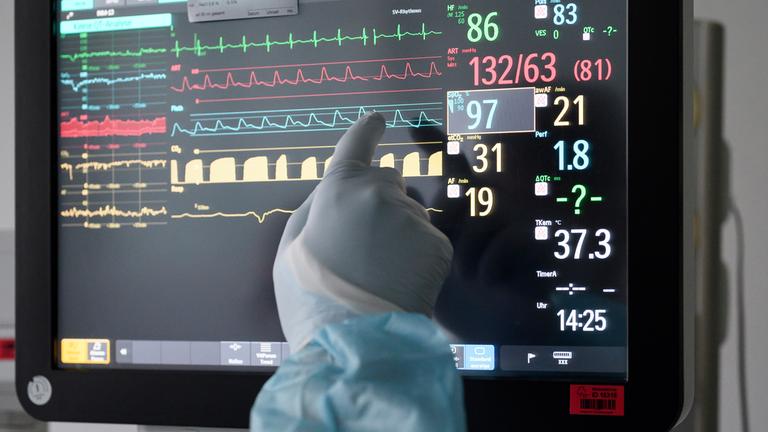 Lebensverlängernde Maßnahmen retten nicht immer – manchmal nehmen sie Würde. Wo liegt die Grenze des medizinisch Machbaren? (Im Bild: Display mit den Werten eines Patienten) 