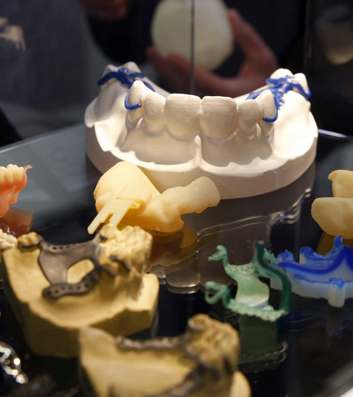 3D-Technik bei Zahnersatz