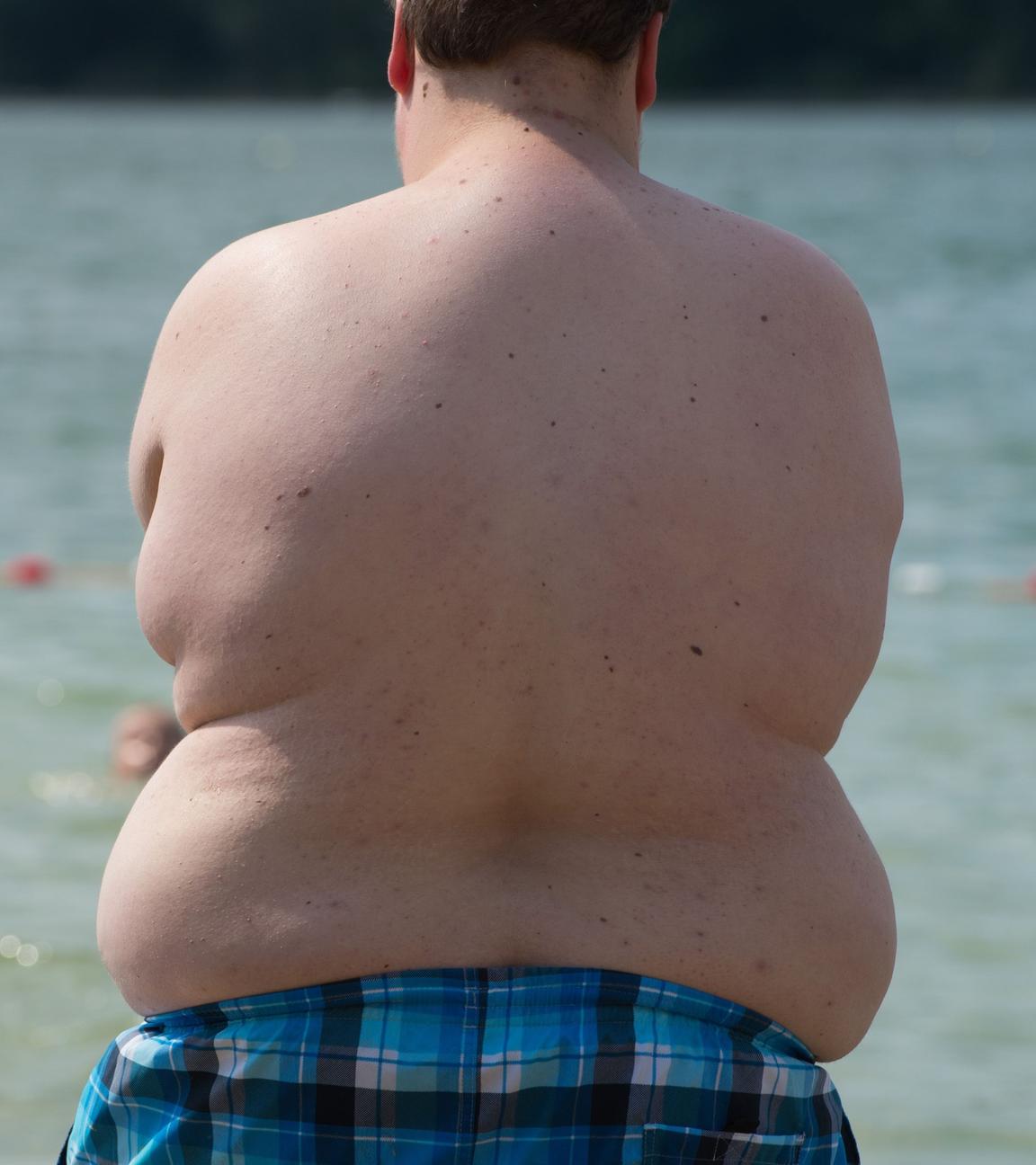 adipositas bei jugendlichen - symbolfoto
