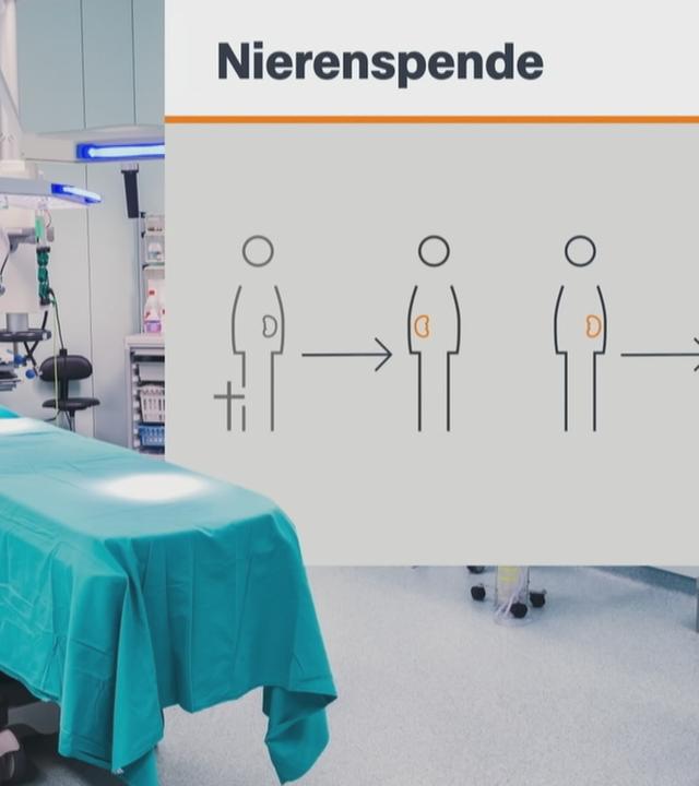 Ein Operationsraum und eine Grafik zu Nierenspenden.