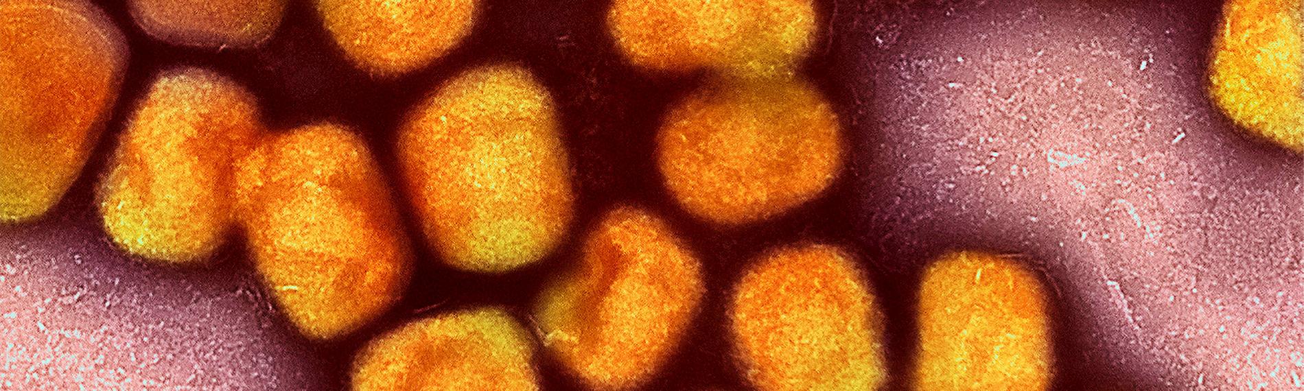 Affenpocken-Virus unter dem Elektronenmikroskop