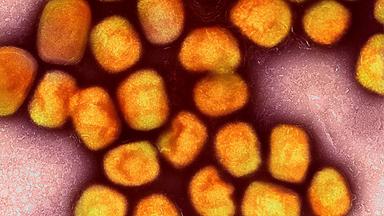 Affenpocken-Virus unter dem Elektronenmikroskop