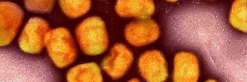 Affenpocken-Virus unter dem Elektronenmikroskop