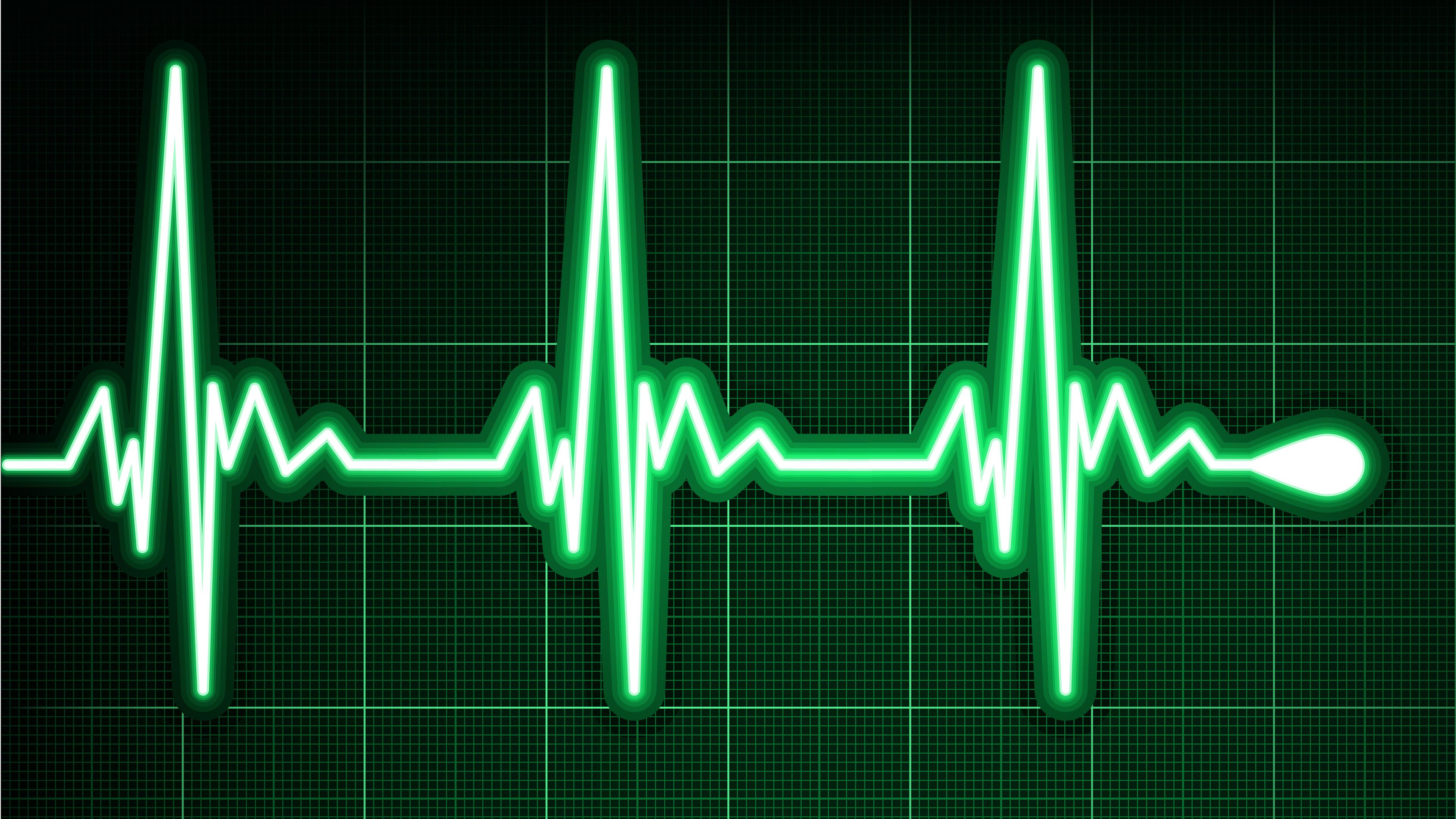 elektrokardiografie (ekg)
