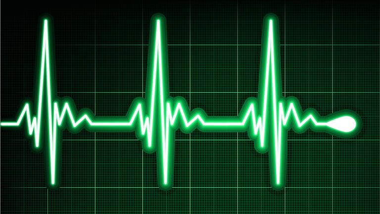 elektrokardiografie (ekg)