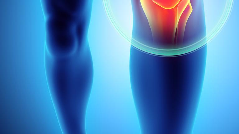 knieschmerz - symbolfoto