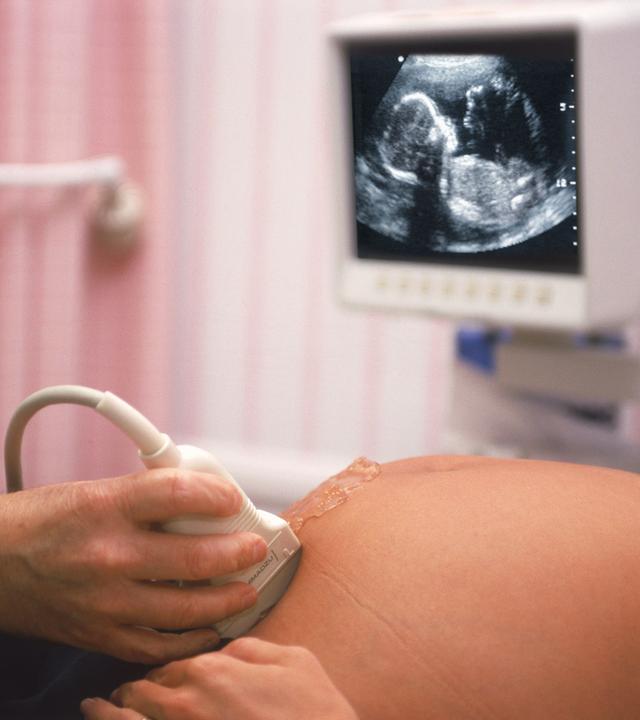 ultraschalluntersuchung in der schwangerschaft