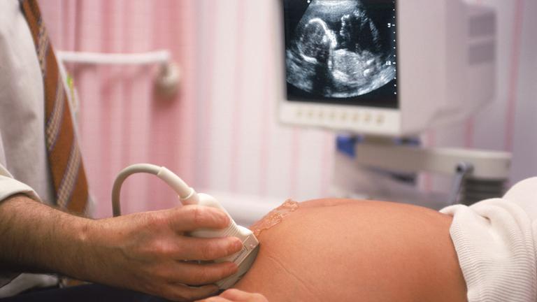 ultraschalluntersuchung in der schwangerschaft