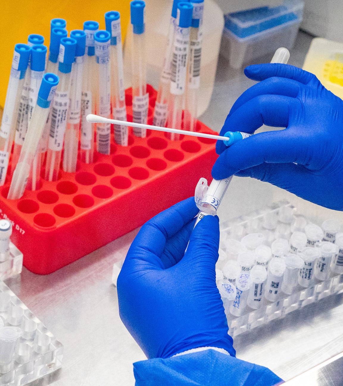 Olekulargenetiker in Schutzkleidung bereitet einen Test auf SARS-CoV-2 vor 