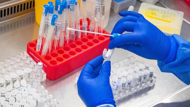 Olekulargenetiker in Schutzkleidung bereitet einen Test auf SARS-CoV-2 vor 