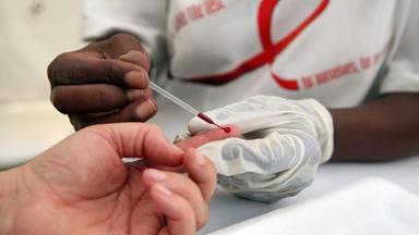 HIV-Test