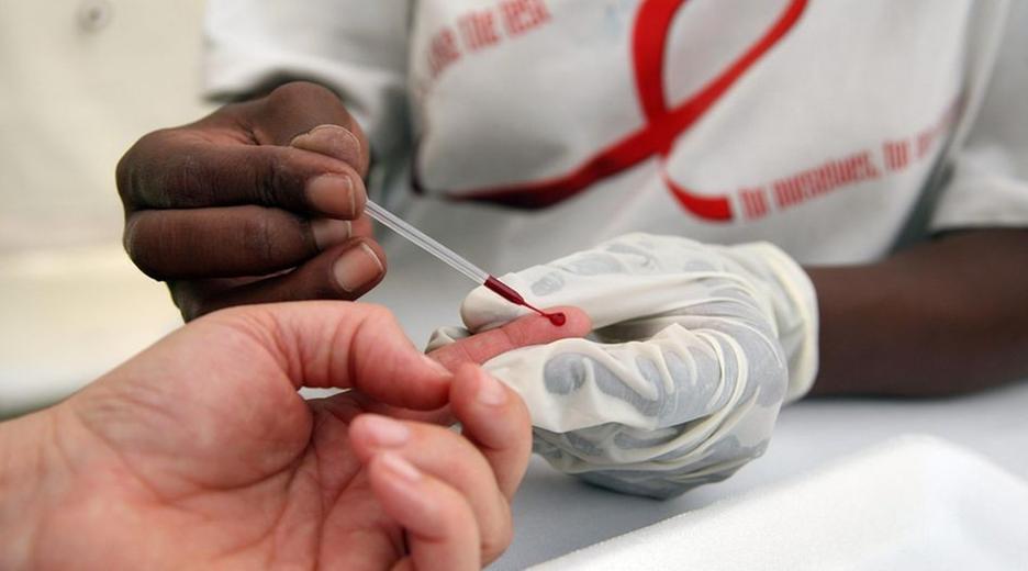 HIV-Test
