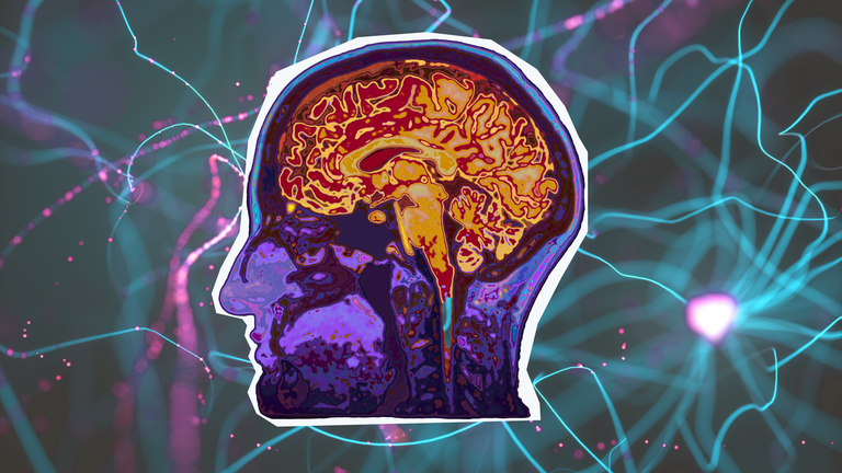 Grafik: Gehirn mit Fragezeichen 