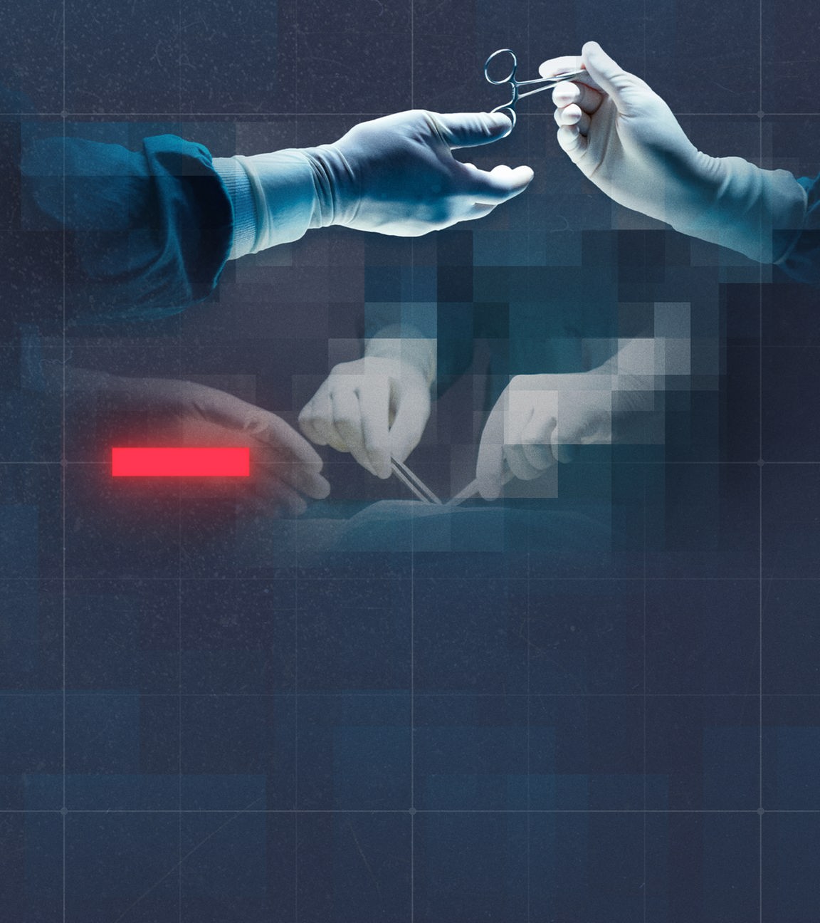 Hände von Operierenden übergeben eine Schere.