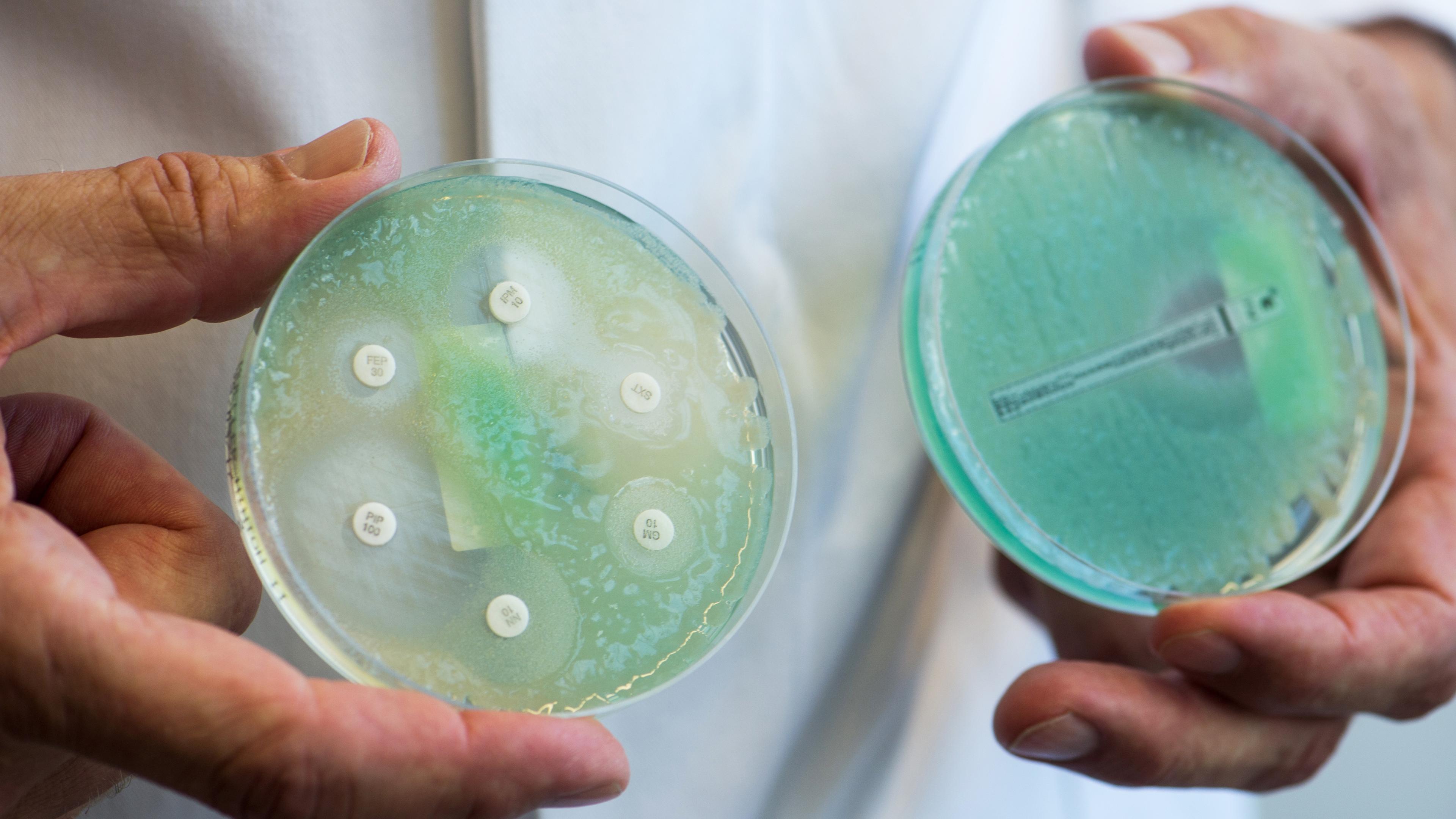Bayern, Regensburg: Petrischalen mit sogenannten Krankenhauskeimen, die Mehrfachresistenzen gegenüber Antibiotika aufweisen. Archivbild