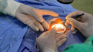 Ärzte führen Hornhauttransplantation bei einem Kind durch.