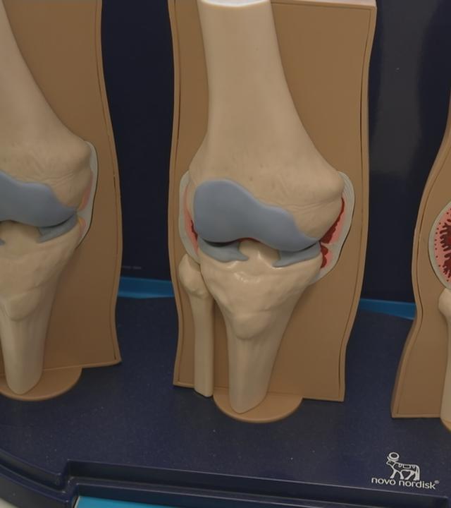 Neue Therapiemethoden bei Hämophilie