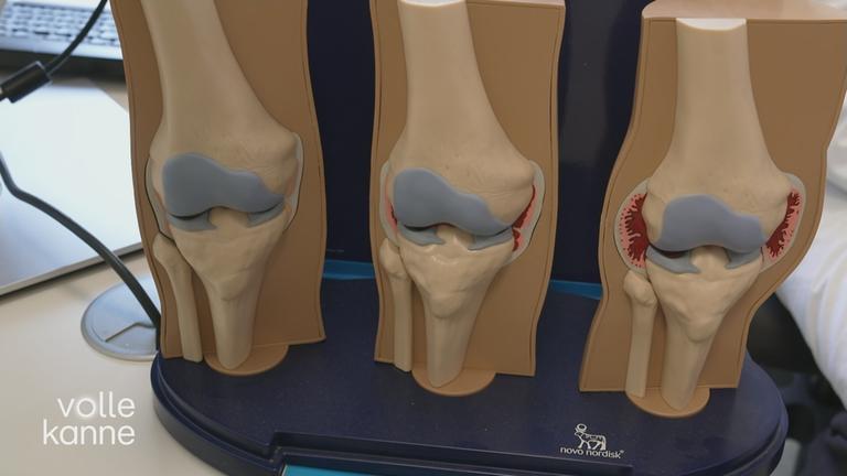 Neue Therapiemethoden bei Hämophilie