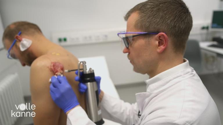 Narbenwucherungen behandeln