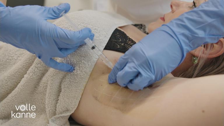 Übermäßiges Schwitzen 