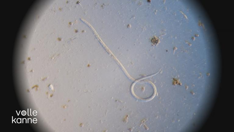 Wurmbefall bei Kindern