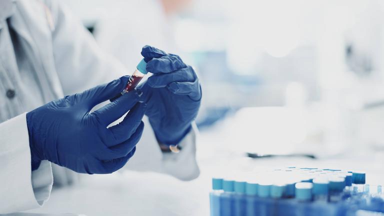 Ein Mann mit blauen Latex-Handschuhen in einem Labor hält eine Blutprobe in der Hand.