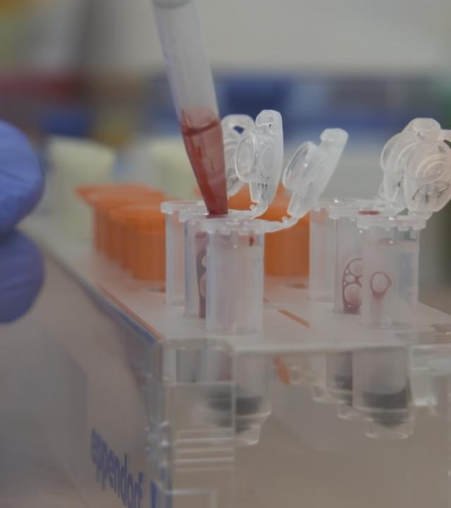 Bluttest zur Parkinson-Früherkennung