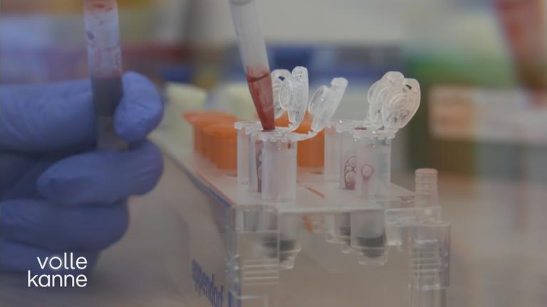 Bluttest zur Parkinson-Früherkennung