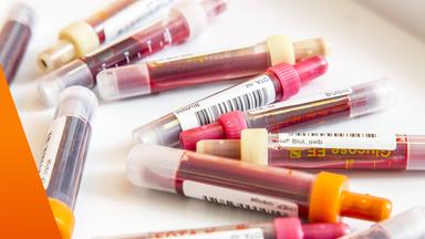 Mehrere unterschiedliche Spritzenampullen mit Blut für ein Blutbild