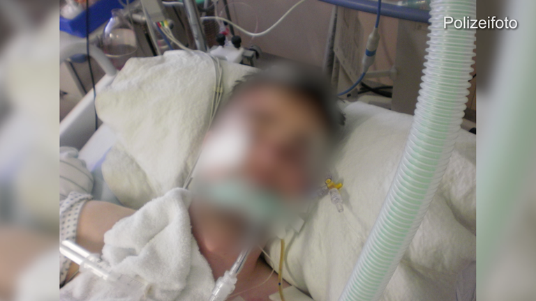 Foto des Verletzten, Gesicht unkenntlich