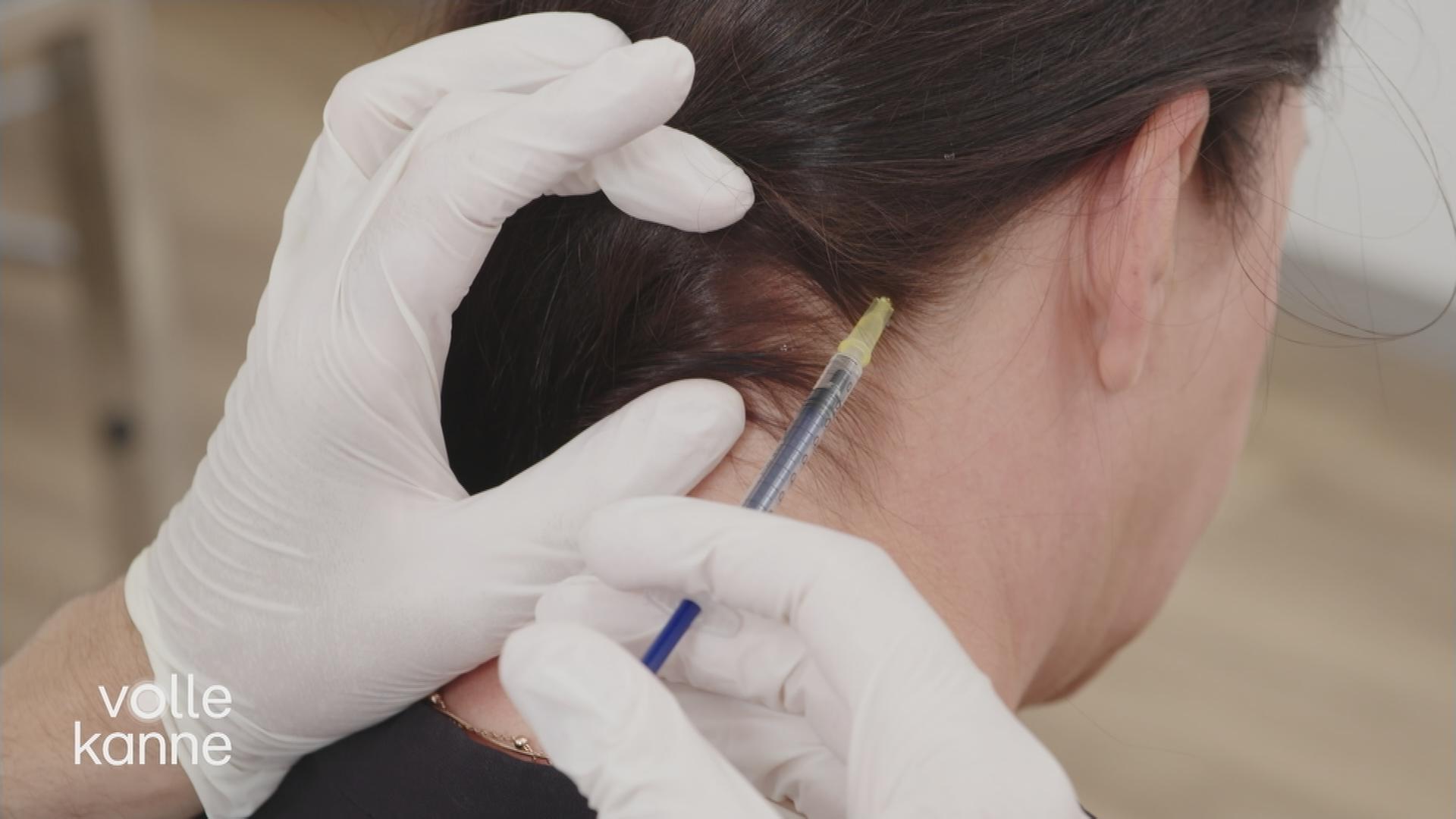 Botox gegen Migräne