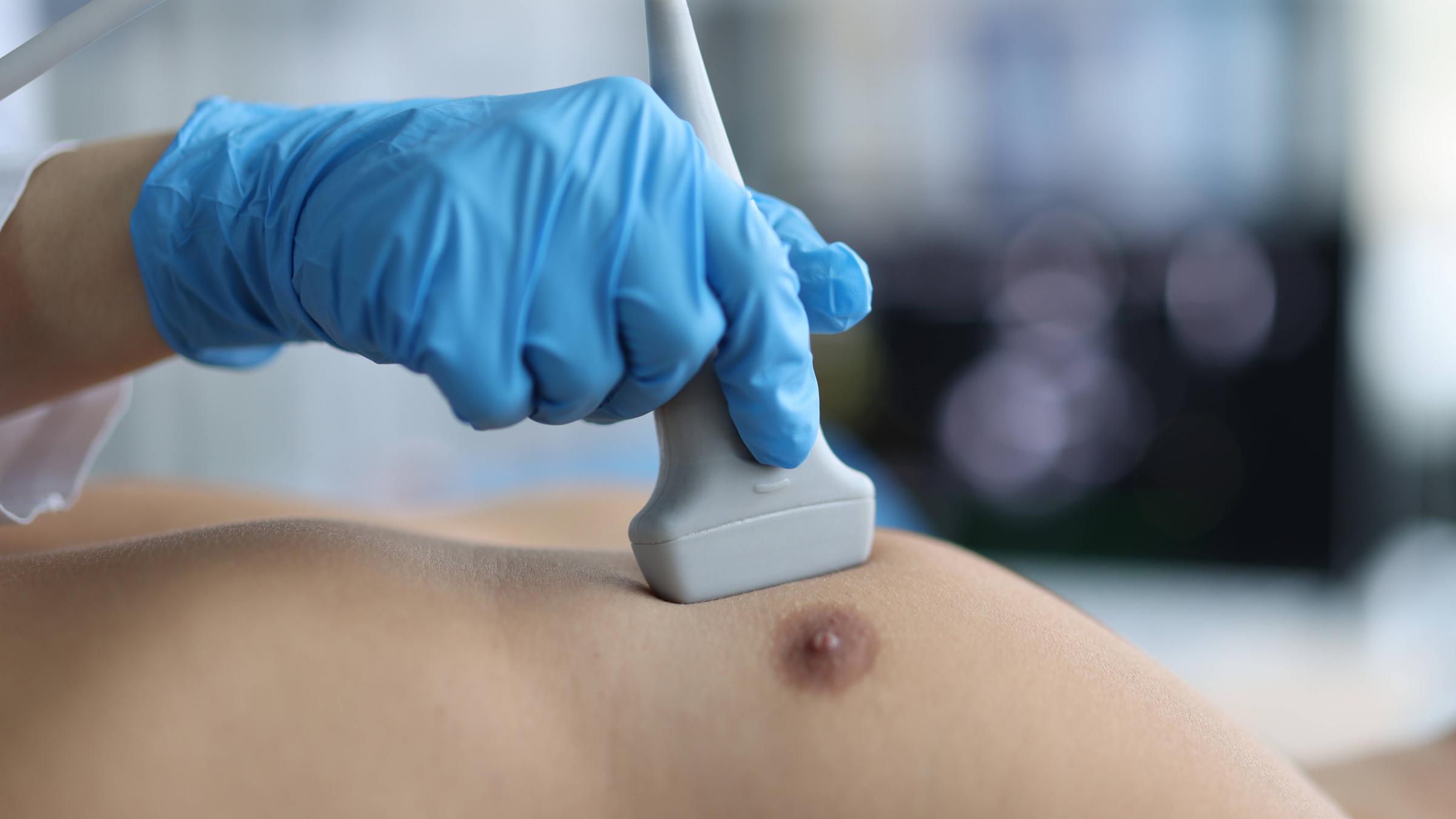 Ultraschalluntersuchung der Brust bei einem Mann.