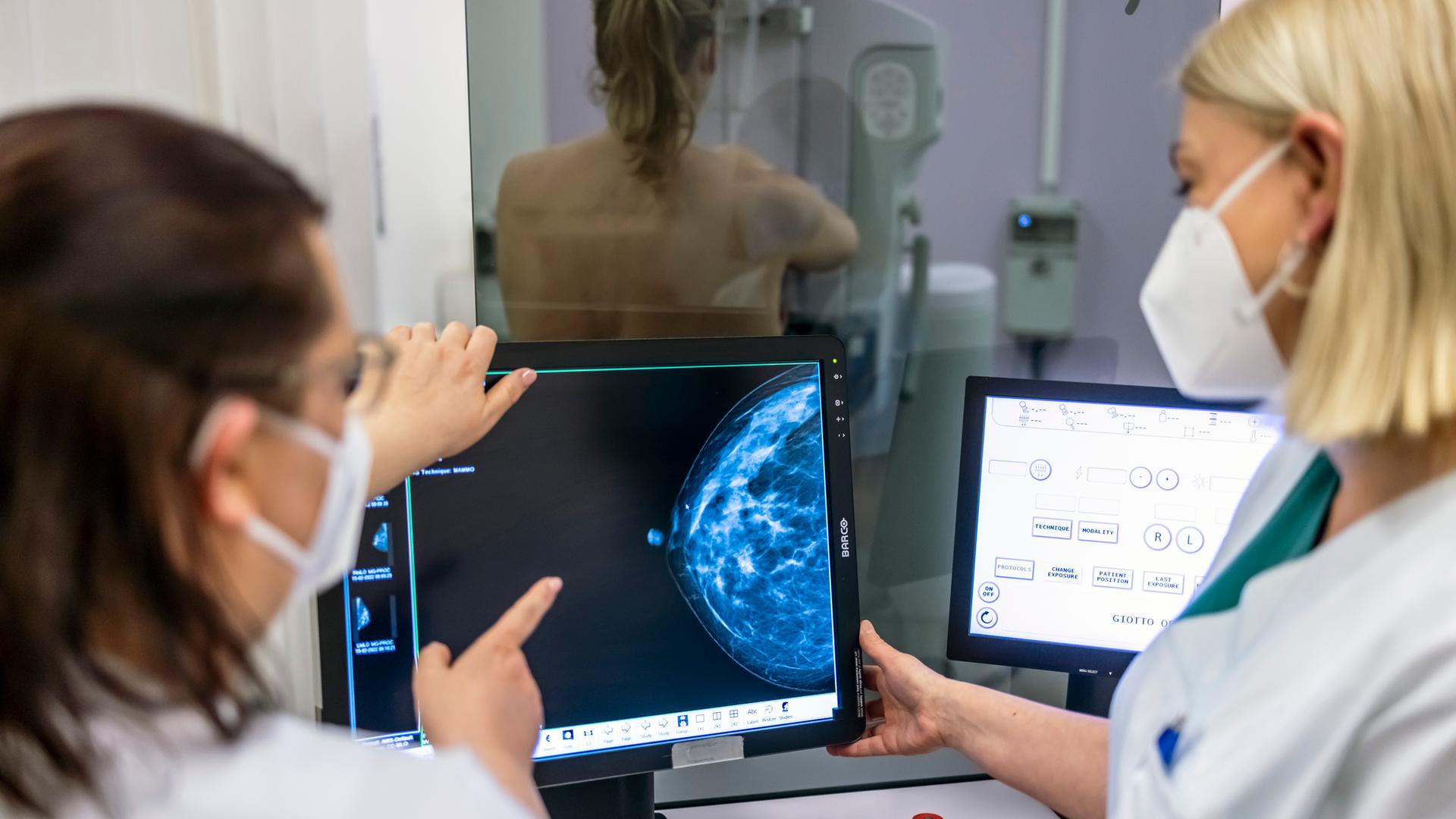 Zwei Ärztinnen schauen sich ein Mammographie-Bild an, das von einer Frau gemacht wurde.