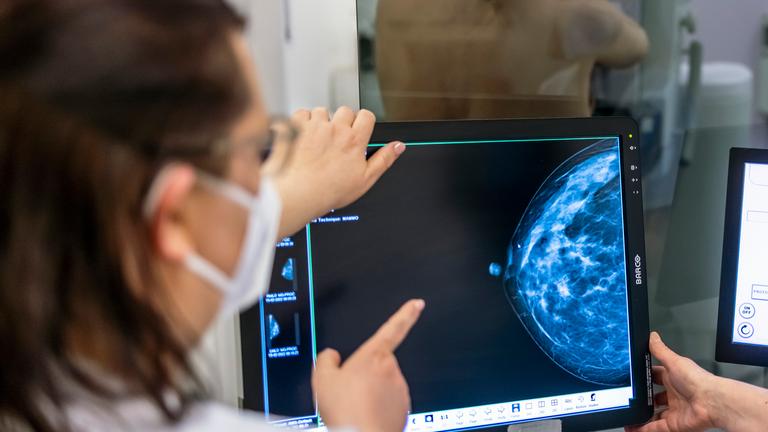 Zwei Ärztinnen schauen sich ein Mammographie-Bild an, das von einer Frau gemacht wurde.