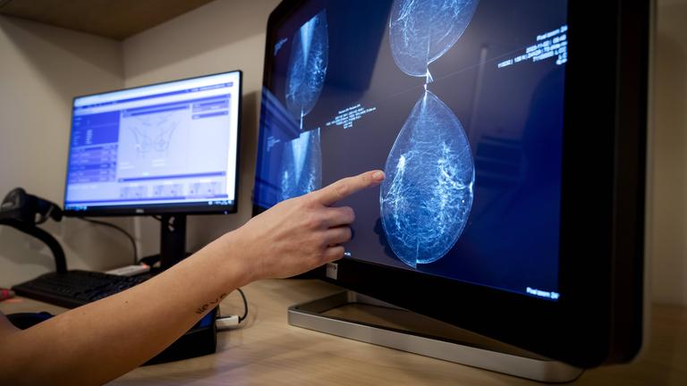 Mammographer with screening employee during a breast cancer examination by an employee of Population Research Netherlands.