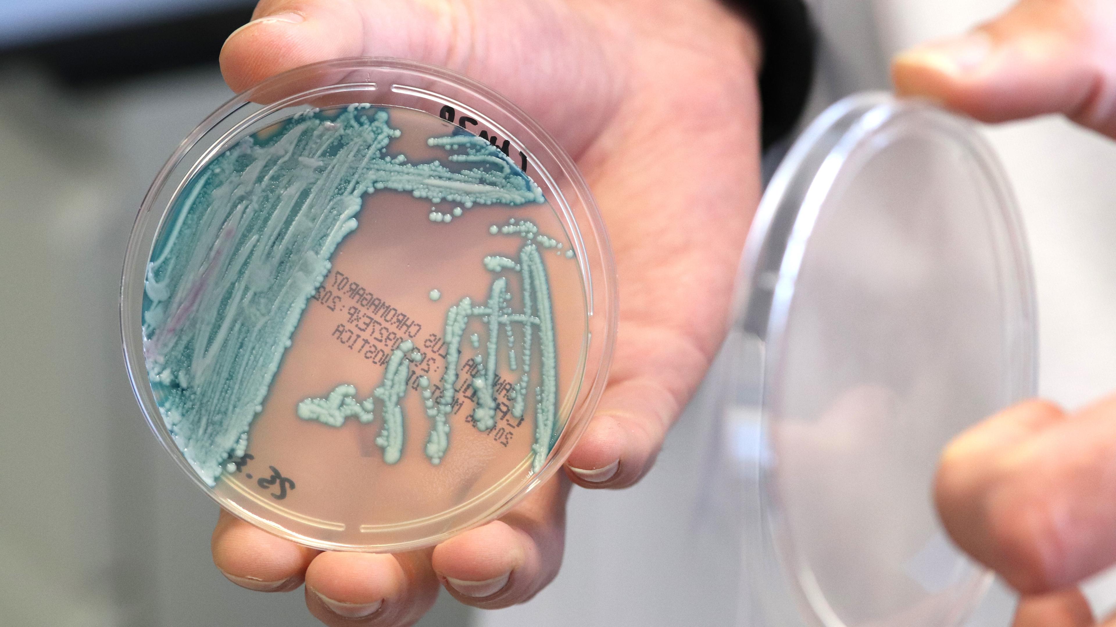Der Pilz Candida auris in einer Petrischale