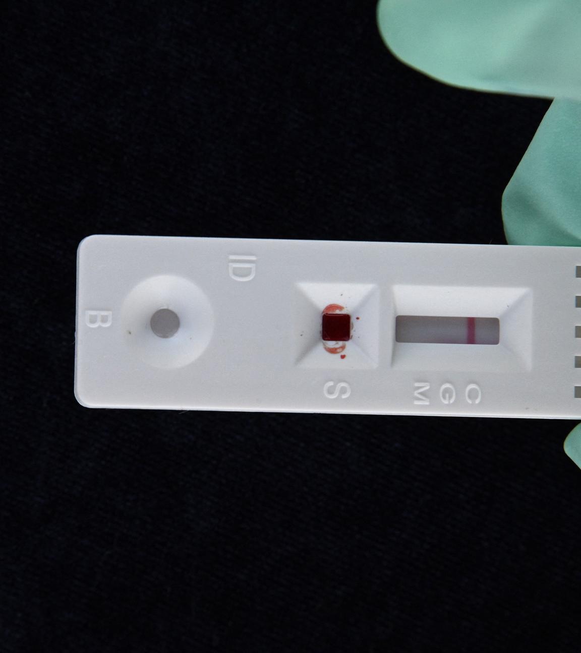Ein serologischer Coronavirus-Antikörper-Schnelltest, der ein negatives Ergebnis für keine Antikörper zeigt