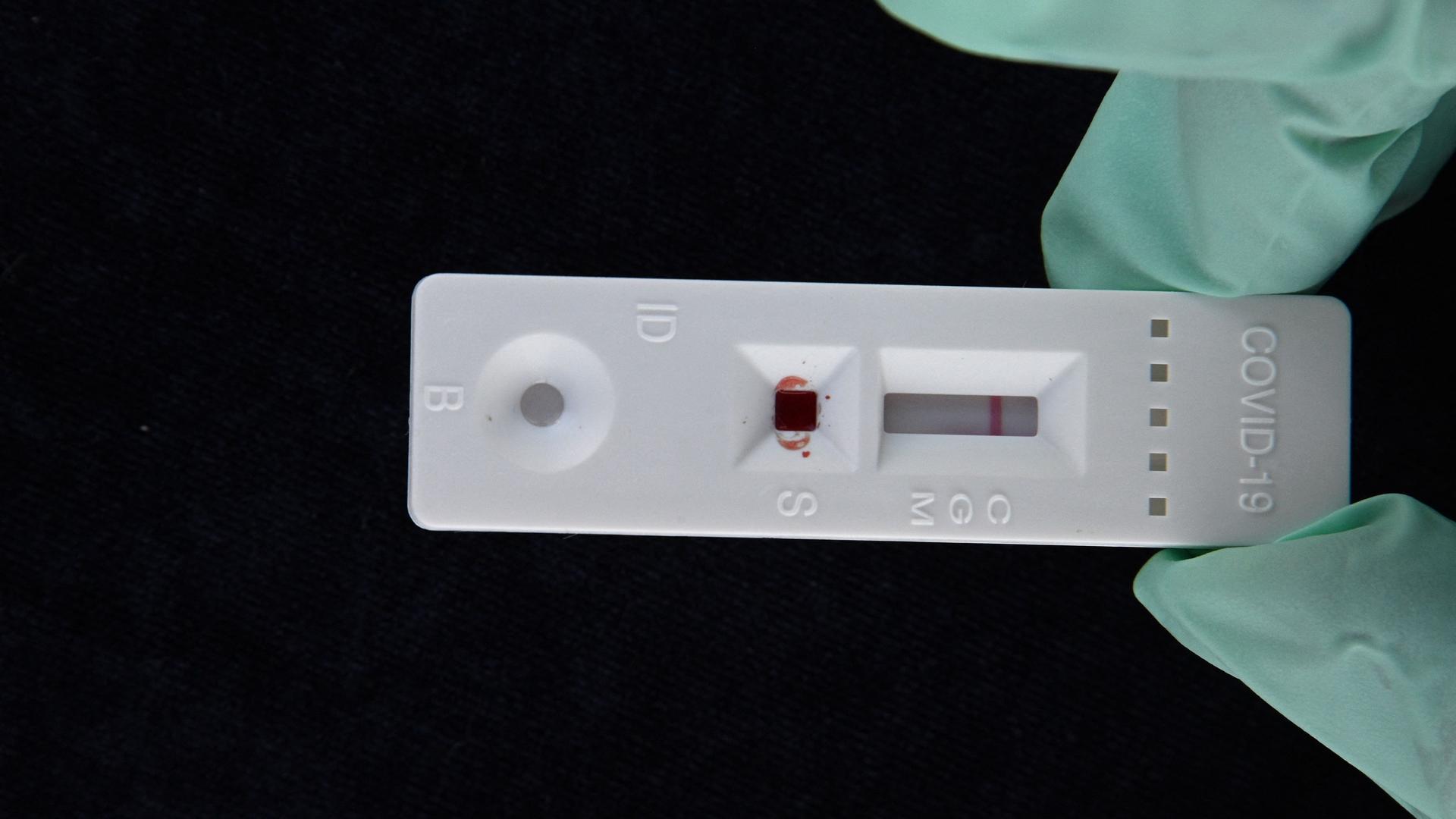 Ein serologischer Coronavirus-Antikörper-Schnelltest, der ein negatives Ergebnis für keine Antikörper zeigt
