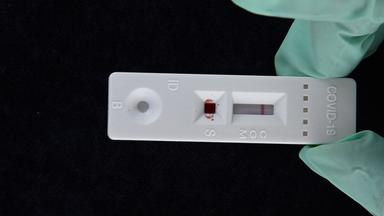 Ein serologischer Coronavirus-Antikörper-Schnelltest, der ein negatives Ergebnis für keine Antikörper zeigt