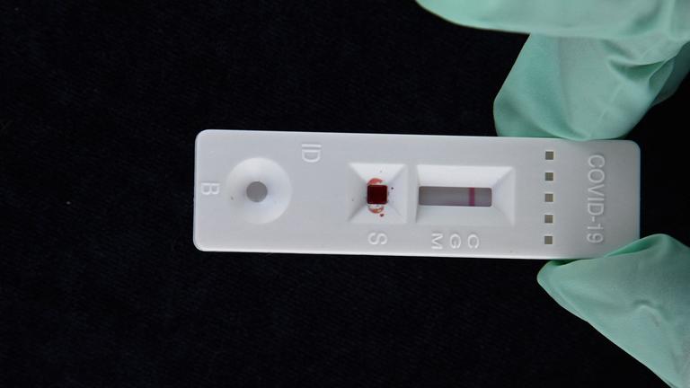 Ein serologischer Coronavirus-Antikörper-Schnelltest, der ein negatives Ergebnis für keine Antikörper zeigt