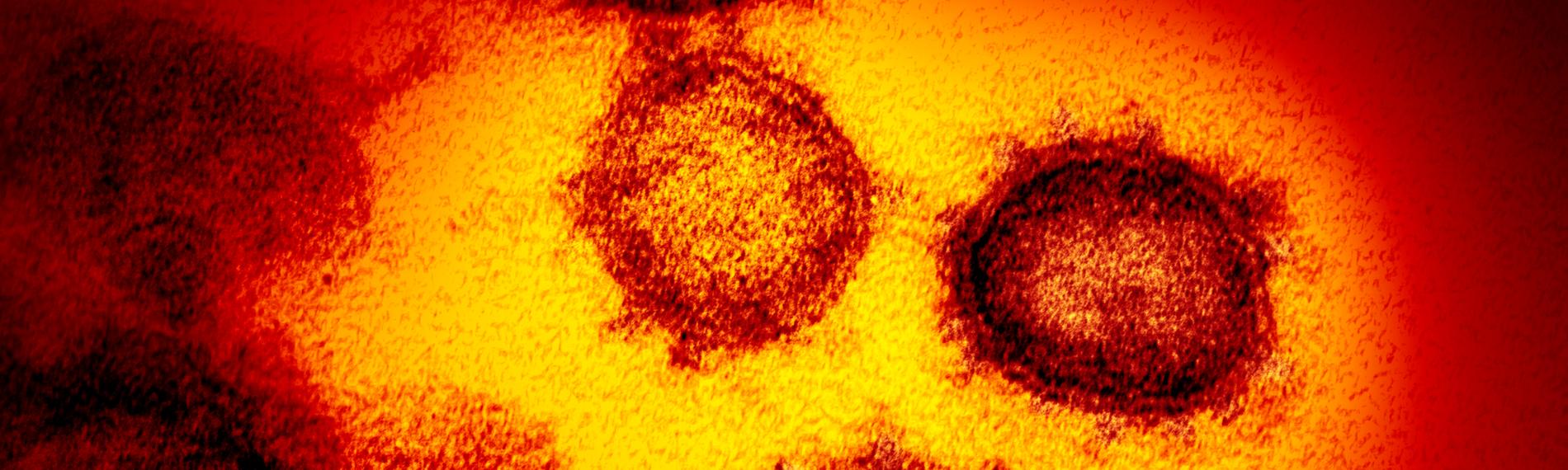 eine undatierte elektronenmikroskopische aufnahme des «u.s. national institute of health» zeigt das neuartige coronavirus
