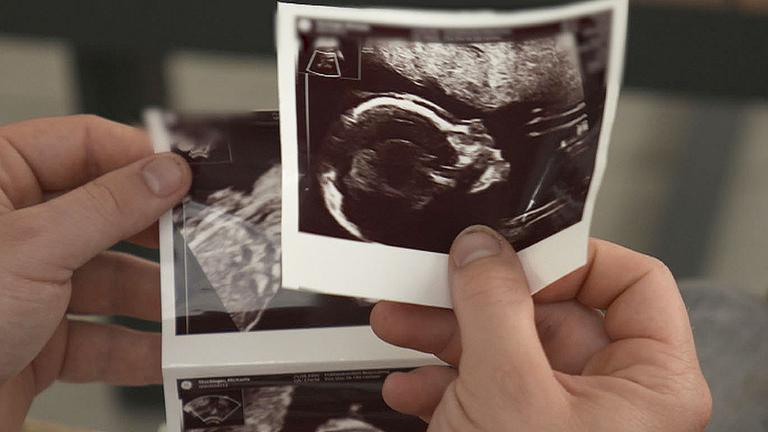 Ultraschallbild mit Fötus